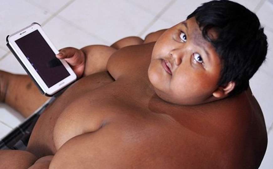 Najdebljem dječaku na svijetu s 200 kilograma odjednom se promijenio život