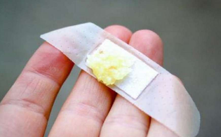 Prirodni lijek: Zalijepite komad bijelog luka na tijelo i zaštite se od bakterija