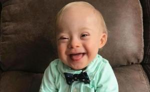 Prva beba s Down sindromom kao zaštitno lice poznate dječje hrane
