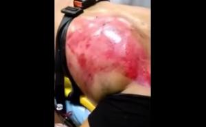 Stravičan snimak: Mladić popio 24 energetska pića, ljekari u šoku 