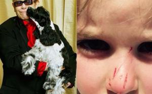 Pas Eltona Johna izgrizao djevojčicu