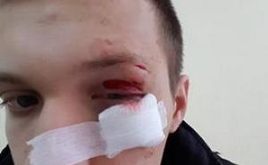 Mladić u Sarajevu pretučen jer je pokušao spriječiti džeparoše u pljački