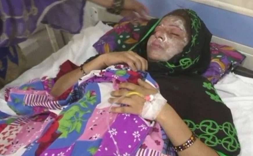 Muškarac polio ženu kiselinom zbog toga što je rodila djevojčicu