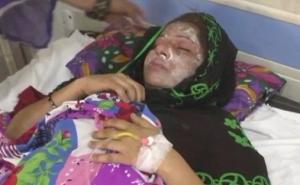 Rodila mu dvije kćerke pa je iz bijesa polio kiselinom