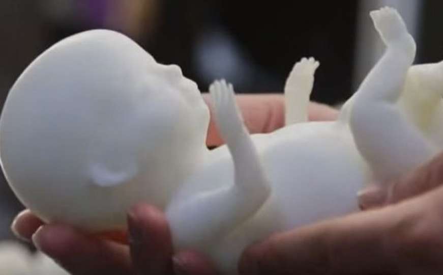 Za roditelje: Od sada svoju nerođenu bebu mogu isprintati u plastici ili zlatu