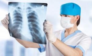BiH: Broj oboljelih od tuberkuloze u stalnom opadanju