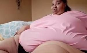 Ženskom modelu teškom 284 kilograma otkazali organi