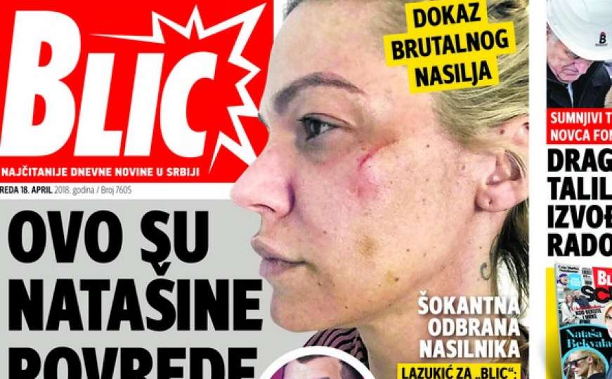 Muž negira nasilje nad Natašom Bekvalac: Modrice zadobila na masaži