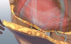 SAD: Prvi put u historiji obavljena transplantacija polnog organa 