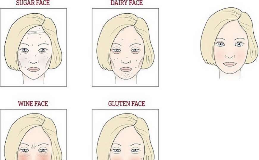 Lice pokazuje šta tijelu najviše smeta: Šećer, gluten, mlijeko ili vino
