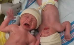 Tek rođeni blizanci oduševili svijet: Plakali sve dok ih nisu ponovo spojili