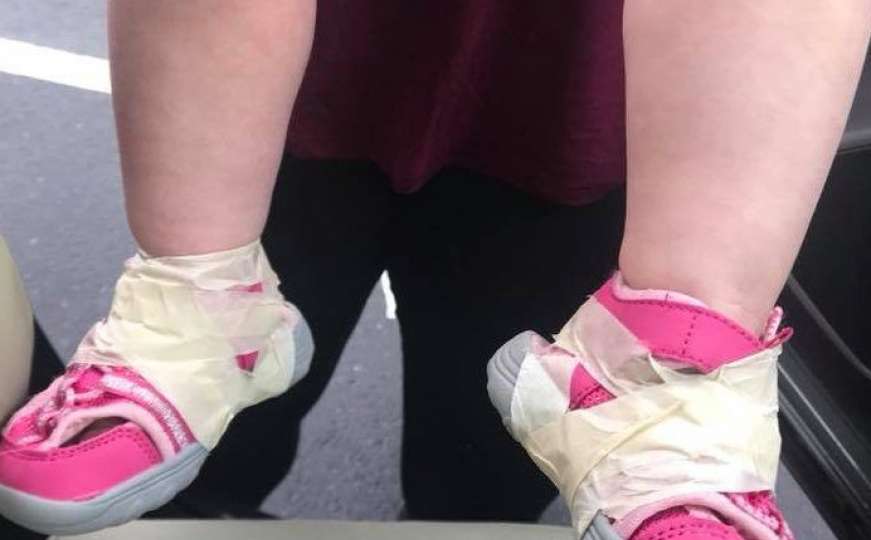 Tete iz vrtića dobile otkaz nakon što su djevojčici zalijepile cipele za noge