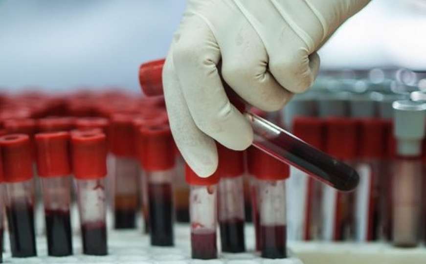 Novi testovi krvi otkrivat će rak godinama prije nastanka