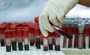 Mitovi: Krv u venama nikada nije plava