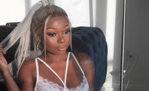 Djevojka s ožiljcima dopustila dečku da je vidi bez šminke: Reakcija ju iznenadila