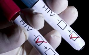 Kineski naučnici otišli korak dalje: Na pomolu lijek za HIV