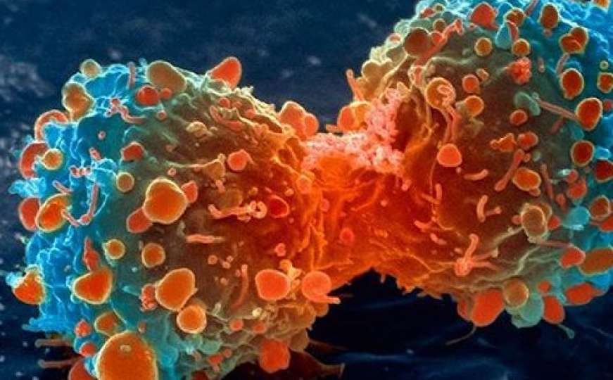 Kanadski naučnici pronašli način da blokiraju metastaze raka