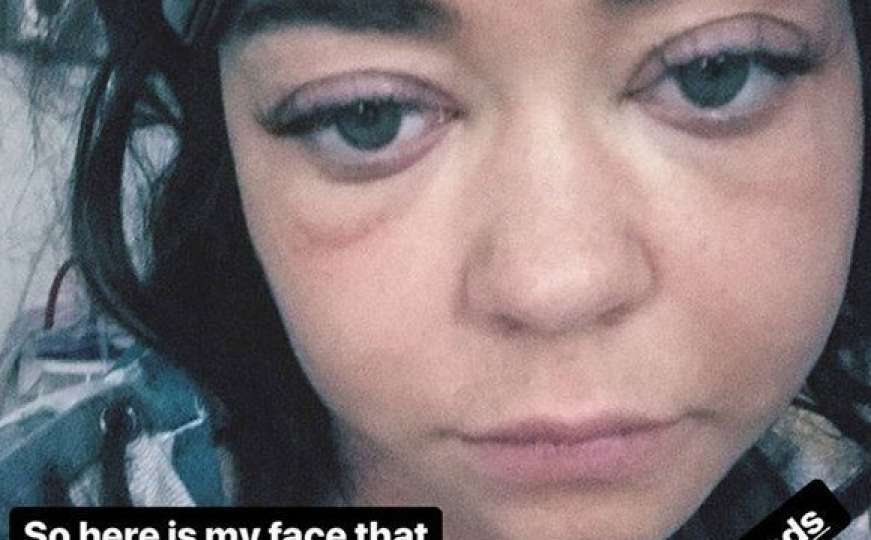 Zvijezda 'Moderne obitelji': Mlada glumica objavila potresni selfie iz bolnice