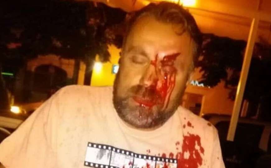 Srbijanski novinar Stefan Cvetković tvrdi da je napadnut