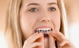 Oprema za izbjeljivanje zuba koja se prodaje na eBayu ozbiljno ugrožava zdravlje!