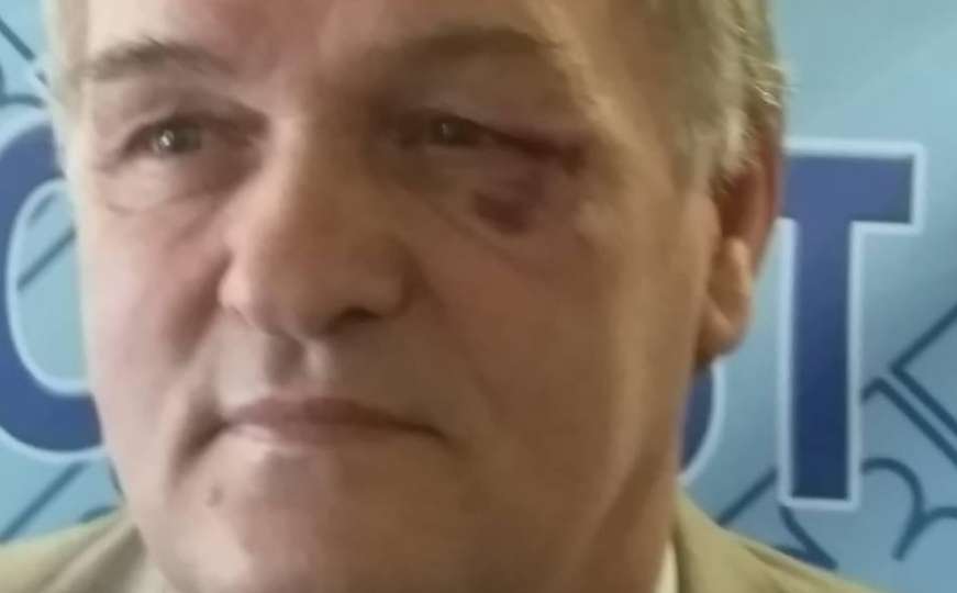 Nepoznata osoba fizički napala Zijada Alajbegovića, zastupnika u Parlamentu FBiH