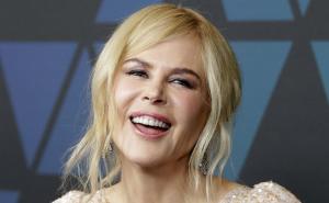 Previše botoksa: Nicole Kidman ne liči više na sebe 