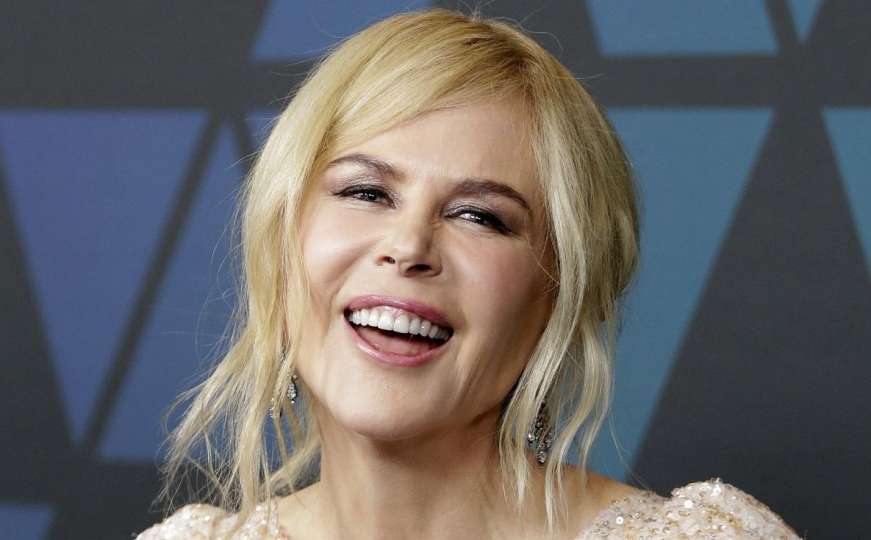 Previše botoksa: Nicole Kidman ne liči više na sebe 