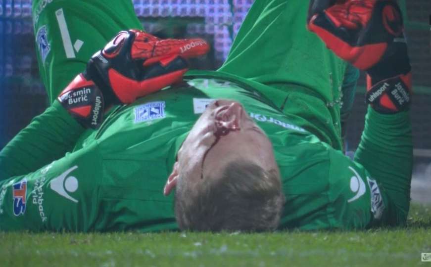 Užasna povreda golmana Zmajeva: Buriću razbili glavu, teren napustio na nosilima