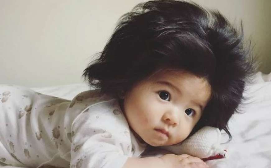 Beba zbog svoje kose postala glavni lik reklama za šampone