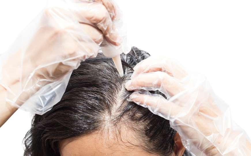 Da li smijete da farbate kosu: Test od 10 sekundi sve otkriva