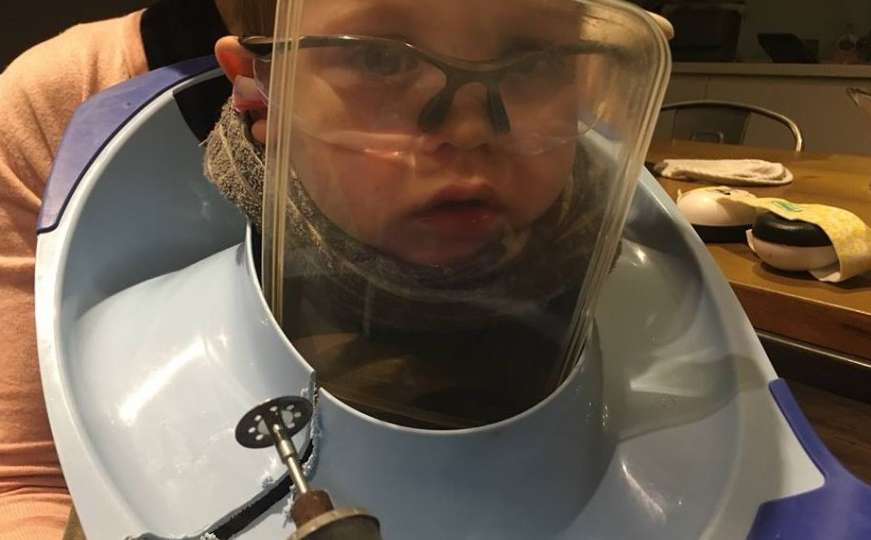 Bizarno: Vatrogasci objavili fotografiju dječaka zaglavljenog u wc šolji