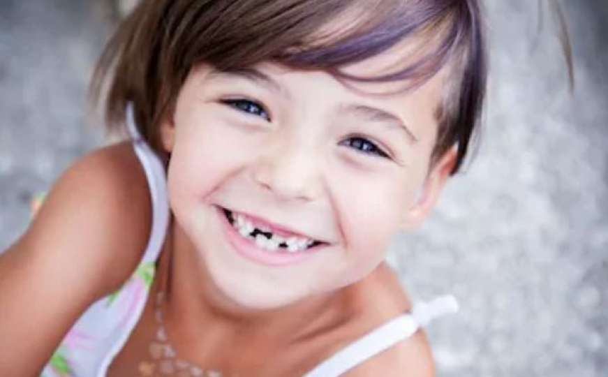 Ljekari savjetuju roditelje: Čuvajte mliječne zube svog djeteta!