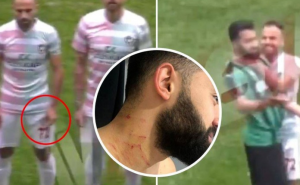 Skandal potresa Tursku: Nogometaš žiletom napadao protivnike