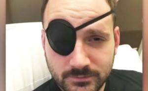 Budite pažljivi kad "pucate vrat": 28-godišnjak imao moždani zbog toga!