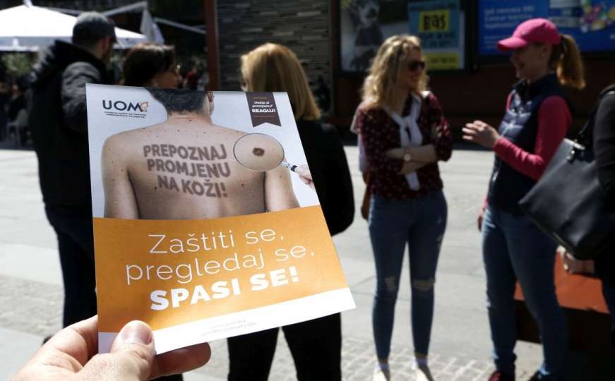 U BiH 250 oboljelih od melanoma: Šta izbjegavati i kad ići na preglede
