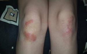 Migrant povrijedio djevojke u Bihaću