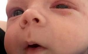 Roditelji, ne dajte da vam ljube djecu! Još jedna beba zamalo umrla zbog poljupca