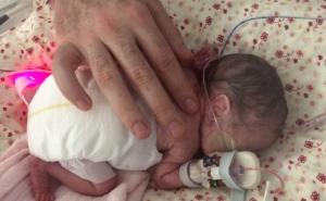 Bila je manja od ruke, a danas je zdrava i vesela djevojčica 