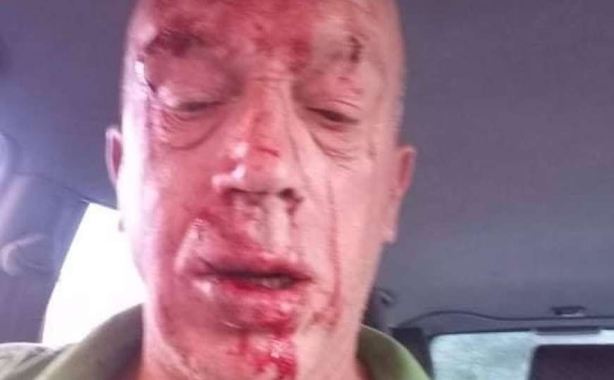 Brutalno pretučen načelnik Civilne zaštite u Tesliću