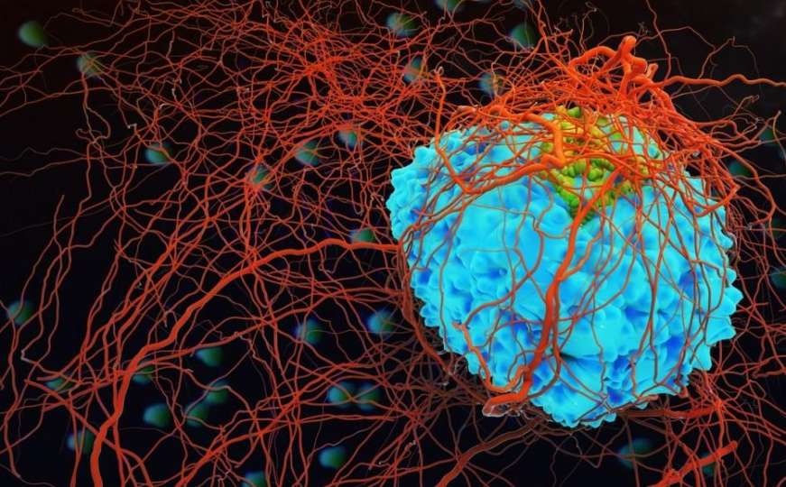 Naučnici otkrili kako unišititi ćelije karcinoma