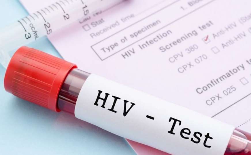 Da li će sida uskoro biti izlječiva - elimisan HIV iz DNK miševa