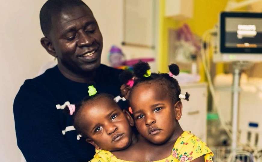 Nevjerovatna drama oca sijamskih blizanki: Kako da odlučim koja će živjeti