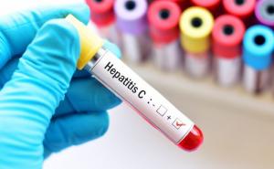 Bečki ljekari osmislili novi način liječenja hepatitisa C