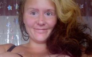 Zbog ogromnih grudi ne može normalno živjeti pa ih je odlučila donirati