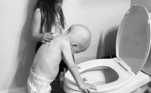 Ova slika rasplakala je svijet: Sestra mazila brata kojem je pozlilo od hemoterapije