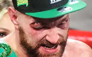 Tyson Fury slavio raskrvavljena oka: Ovo je najgori meč ikad