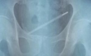 Toplomjer ugurao tamo gdje ne bi ni tehnički trebalo biti moguće