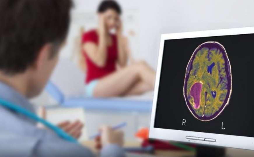 Obratite pažnju: Sedam simptoma tumora na mozgu koje morate znati