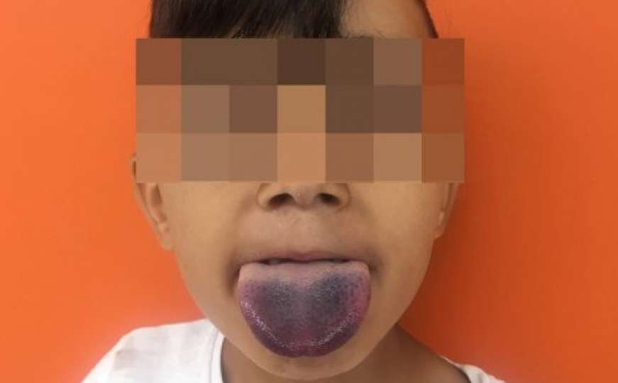 Dječaku se jezik zaglavio u boci: Ljekar ga oslobodio genijalnim trikom