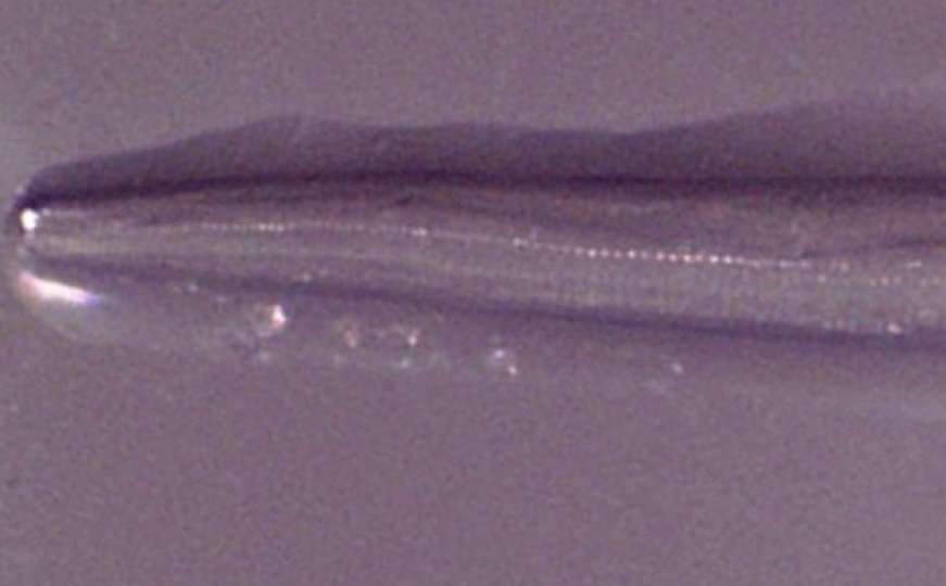Žena pronašla parazitske crve u očima nakon što je prošla kroz roj muha